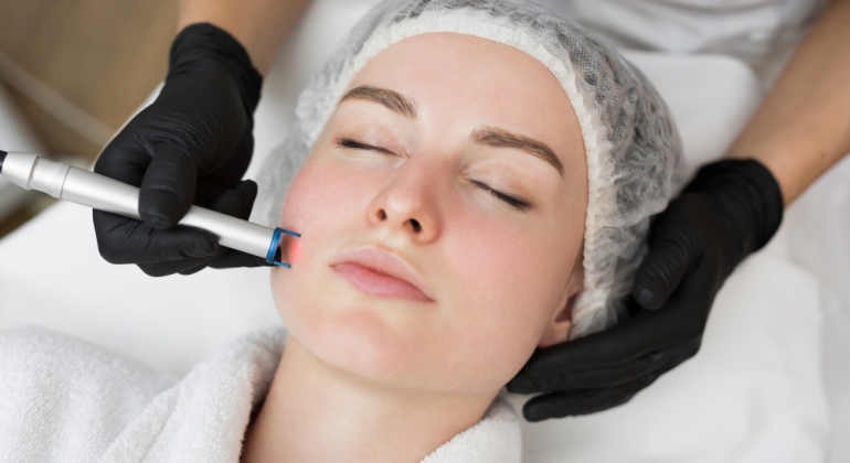 microneedling acupuncture oc