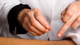 understanding the basics of acupuncture and how it works
