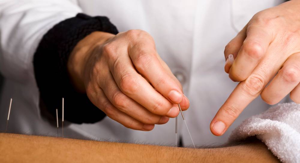 understanding the basics of acupuncture and how it works