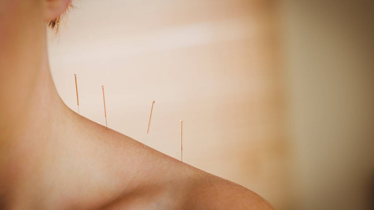 how can acupuncture help with weight loss and how does it work