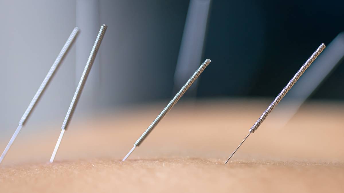 what are the long term benefits of regular acupuncture treatments