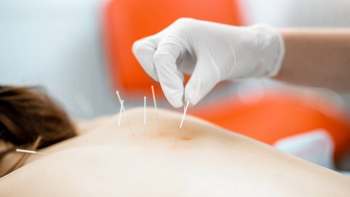 what are the long term benefits of regular acupuncture treatments