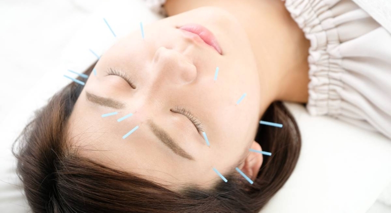 how can acupuncture improve mental health and well being