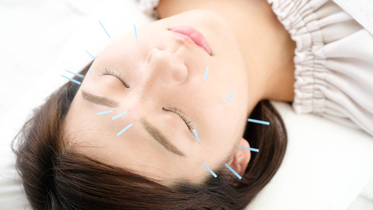 how can acupuncture improve mental health and well being