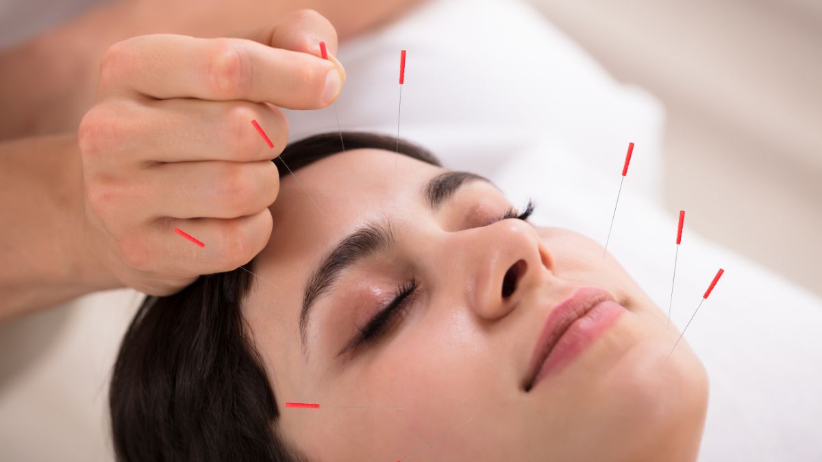 what are the benefits of acupuncture for chronic fatigue