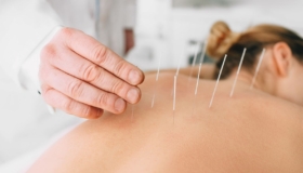 long term benefits acupuncture