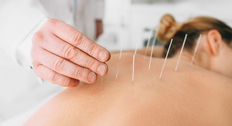 long term benefits acupuncture