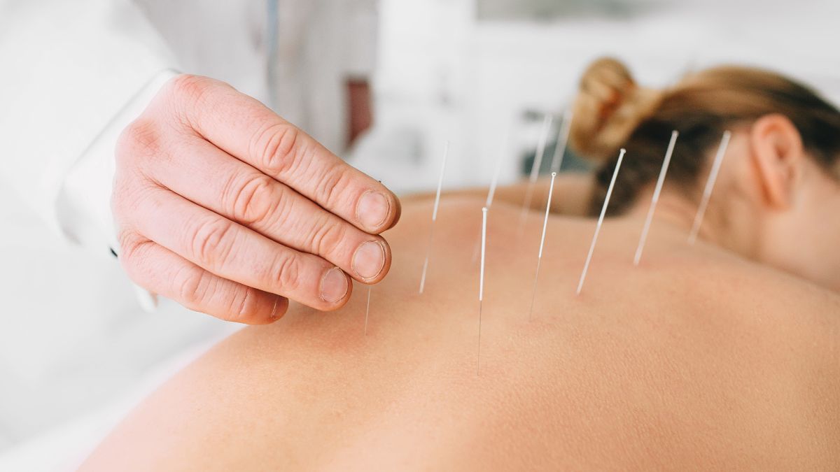long term benefits acupuncture