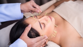 facial acupuncture improves skin and reduces wrinkles