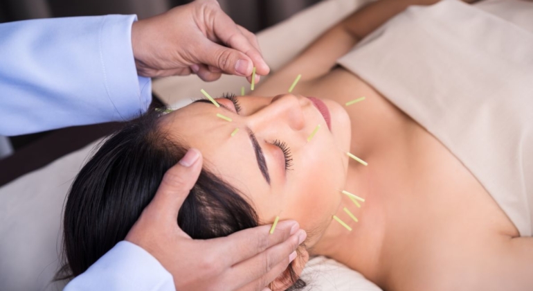 facial acupuncture improves skin and reduces wrinkles
