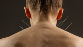 rise acupuncture orange county ca