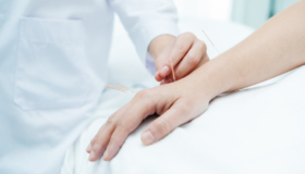 acupuncture the key to better-health oc