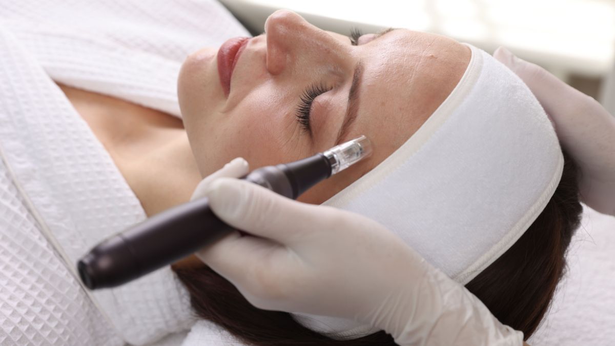 what should you avoid before and after microneedling