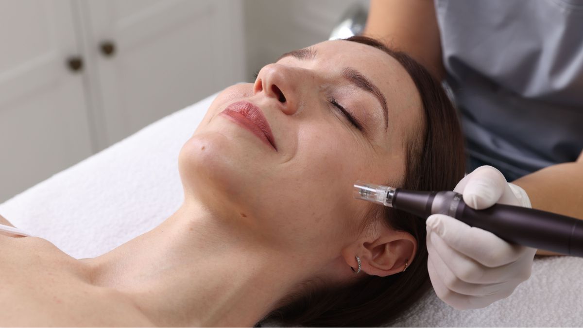 what should you avoid before and after microneedling