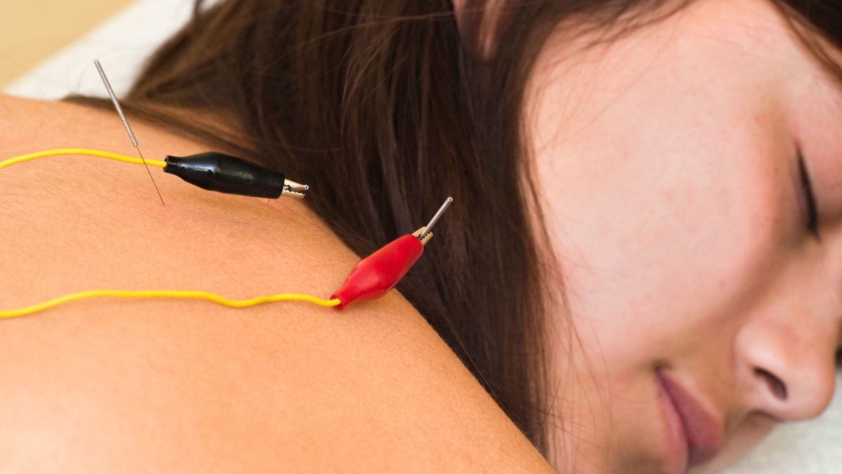 what should you expect after neuropuncture session