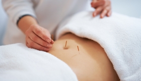 acupuncture for weight loss orange county ca