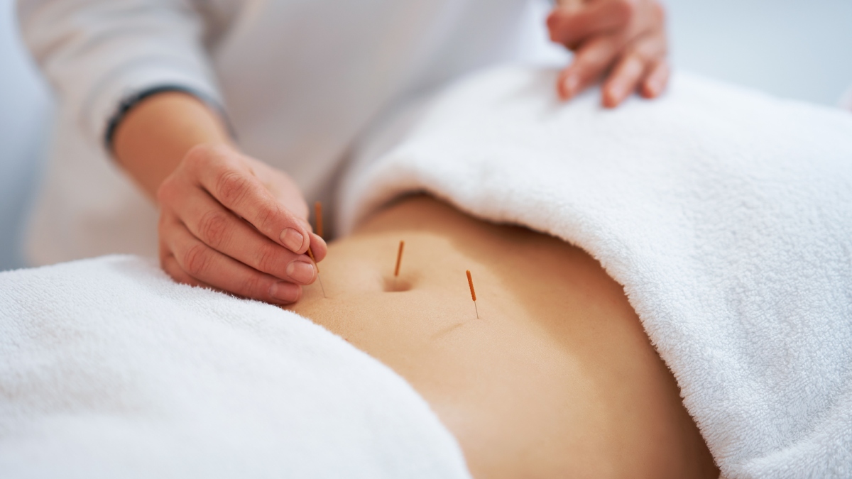 acupuncture for weight loss orange county ca