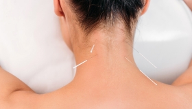 acupuncture help neck pain