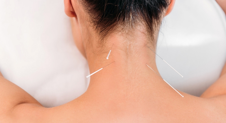 acupuncture help neck pain